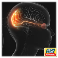 Understanding Occipital Neuralgia