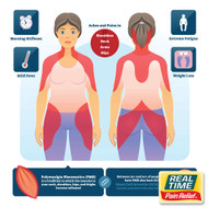 Polymyalgia Rheumatica: Managing Pain and Stiffness