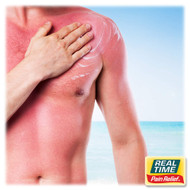 Sunburn, Chafing, and Skin Irritations: Nature’s Soothing Solutions