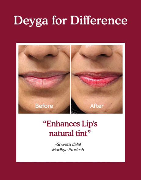 Deyga Beetroot Lip balm Stick - Case