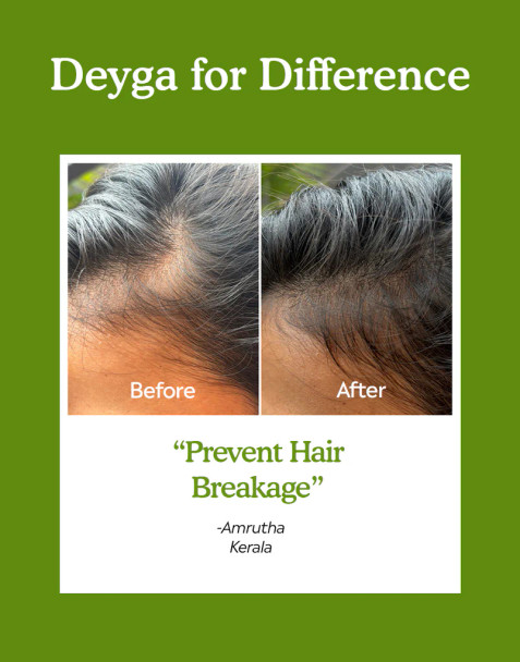 Deyga Hair Growth Oil - Case