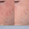 Daily Microfoliant Refill