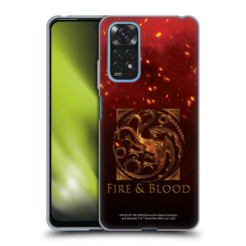 House Of The Dragon: Television Series Key Art Targaryen Soft Gel Case for Xiaomi Redmi Note 11 / Redmi Note 11S