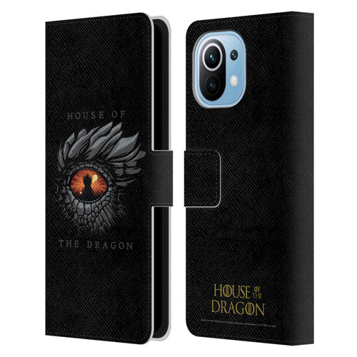 House Of The Dragon: Television Series Graphics Dragon Eye Leather Book Wallet Case Cover For Xiaomi Mi 11