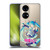 Hatsune Miku Graphics Sing Soft Gel Case for Huawei P50