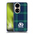 Scotland Rugby Logo 2 Tartans Soft Gel Case for Huawei P50