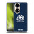 Scotland Rugby Graphics Pattern Soft Gel Case for Huawei P50
