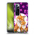 Kayomi Harai Animals And Fantasy Mother & Baby Fox Soft Gel Case for Xiaomi Mi 10 Ultra 5G