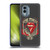 The Rolling Stones Key Art Jumbo Tongue Soft Gel Case for Nokia X30