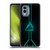 Alyn Spiller Neon Green Soft Gel Case for Nokia X30