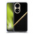 Alyn Spiller Carbon Fiber Gold Soft Gel Case for Huawei P50