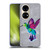 Artpoptart Animals Hummingbird Soft Gel Case for Huawei P50