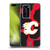 NHL Calgary Flames Cow Pattern Soft Gel Case for Huawei P40 Pro / P40 Pro Plus 5G