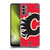 NHL Calgary Flames Oversized Soft Gel Case for Motorola Moto G60 / Moto G40 Fusion