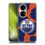 NHL Edmonton Oilers Cow Pattern Soft Gel Case for Huawei P50