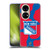 NHL New York Rangers Cow Pattern Soft Gel Case for Huawei P50