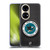 NHL San Jose Sharks Puck Texture Soft Gel Case for Huawei P50