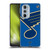 NHL St Louis Blues Oversized Soft Gel Case for Motorola Edge X30