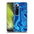 Suzan Lind Marble Blue Soft Gel Case for Xiaomi Mi 10 Ultra 5G