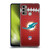 NFL Miami Dolphins Graphics Football Soft Gel Case for Motorola Moto G60 / Moto G40 Fusion