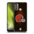 NFL Cleveland Browns Artwork LED Soft Gel Case for Motorola Moto G60 / Moto G40 Fusion