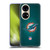 NFL Miami Dolphins Artwork LED Soft Gel Case for Huawei P50