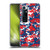 Ameritech Graphics Digital Camouflage Soft Gel Case for Xiaomi Mi 10 Ultra 5G