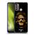 Alchemy Gothic Skull Death Fetish Soft Gel Case for Motorola Moto G60 / Moto G40 Fusion
