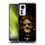 Alchemy Gothic Skull Death Fetish Soft Gel Case for Xiaomi 12 Lite
