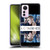 Justin Bieber Purpose Mirrored Soft Gel Case for Xiaomi 12 Lite