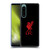 Liverpool Football Club Liver Bird Red Logo On Black Soft Gel Case for Sony Xperia 5 IV