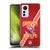 NFL Kansas City Chiefs Logo Art Football Stripes Soft Gel Case for Xiaomi 12 Lite