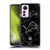 NFL Detroit Lions Artwork Marble Soft Gel Case for Xiaomi 12 Lite