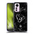 NFL Houston Texans Artwork Marble Soft Gel Case for Xiaomi 12 Lite