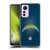 NFL Los Angeles Chargers Artwork LED Soft Gel Case for Xiaomi 12 Lite