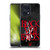 Black Veil Brides Band Art Zombie Hands Soft Gel Case for OPPO Find X5 Pro