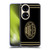 AC Milan Crest Black And Gold Soft Gel Case for Huawei P50
