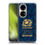Scotland Rugby 150th Anniversary Thistle Soft Gel Case for Huawei P50