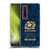 Scotland Rugby 150th Anniversary Thistle Soft Gel Case for OPPO Find X2 Pro 5G