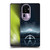 Westworld Graphics The Vitruvian Man Soft Gel Case for OPPO Reno10 Pro+
