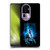 Black Lightning Key Art Give The People Hope Soft Gel Case for OPPO Reno10 Pro+