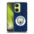 Manchester City Man City FC Patterns Dark Blue Soft Gel Case for OnePlus Nord CE 3 Lite 5G