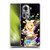 Hatsune Miku Characters Kagamine Rin Soft Gel Case for OPPO Reno11