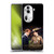 Outlander Characters Jamie And Claire Soft Gel Case for OPPO Reno11 Pro