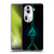 Alyn Spiller Neon Green Soft Gel Case for OPPO Reno11 Pro