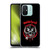 Motorhead Logo Everything Louder Than Everything Else Soft Gel Case for Xiaomi Redmi 12C
