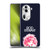 Rod Stewart Art Neon Soft Gel Case for OPPO Reno11 Pro