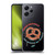 Seinfeld Graphics These Pretzels Soft Gel Case for Xiaomi Redmi 12