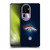 NFL Denver Broncos Artwork LED Soft Gel Case for OPPO Reno10 Pro+