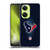 NFL Houston Texans Artwork LED Soft Gel Case for OnePlus Nord CE 3 Lite 5G
